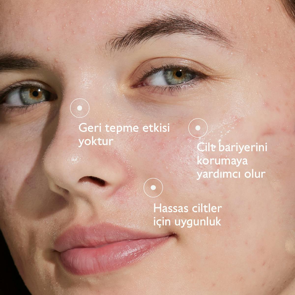 Akne Karşıtı Salisilik Serum