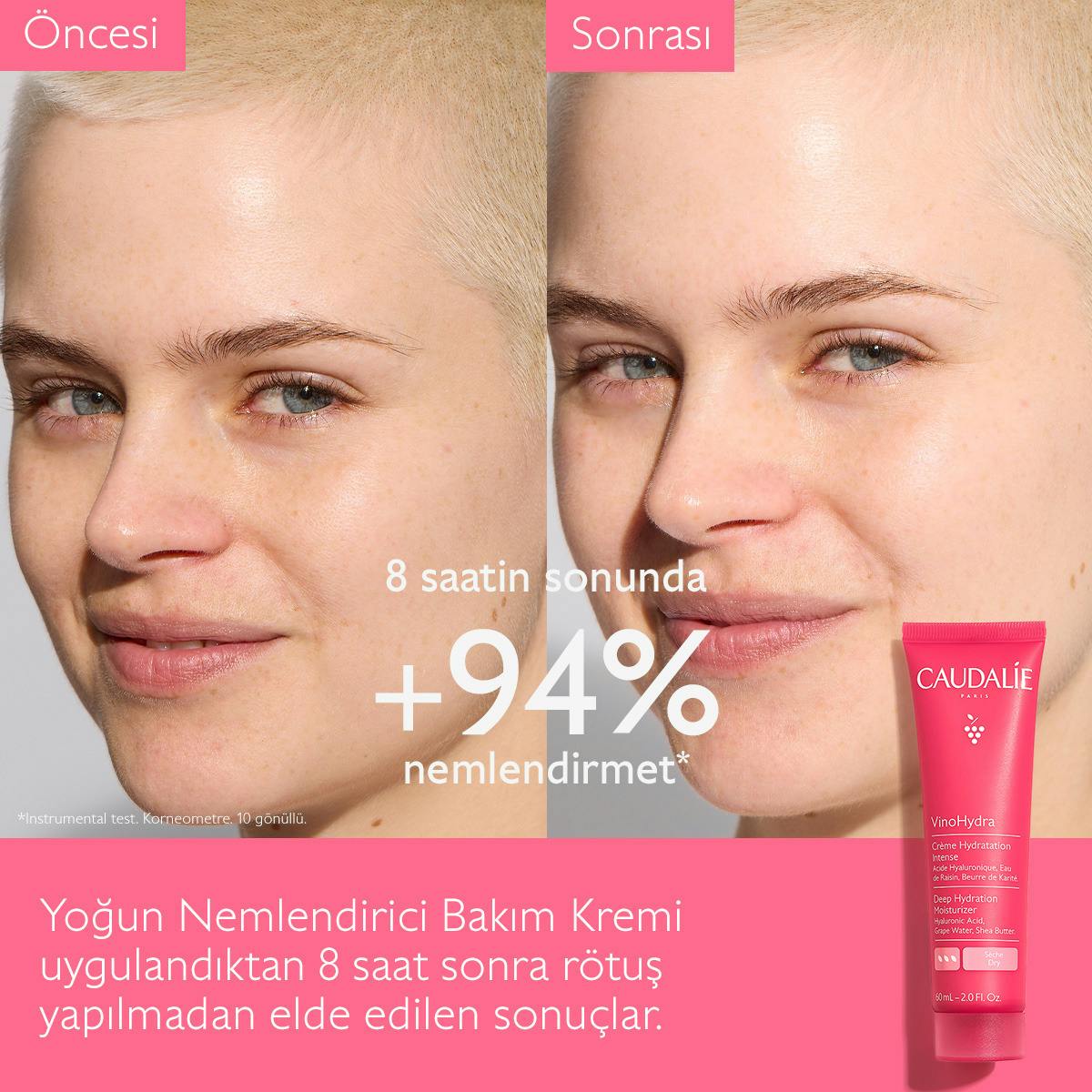 Before and After