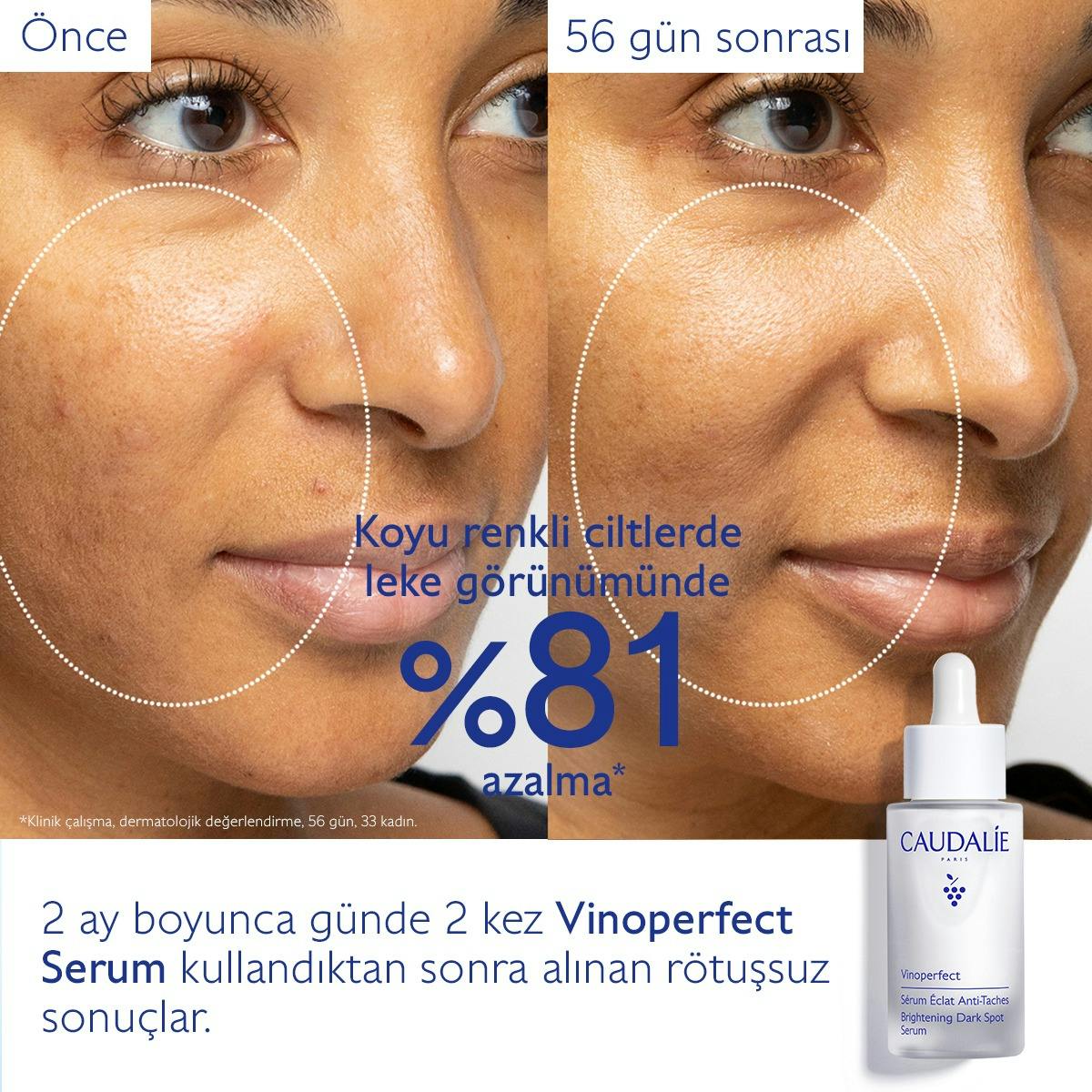 Leke Karşıtı Işıltı Verici Serum - 30ml