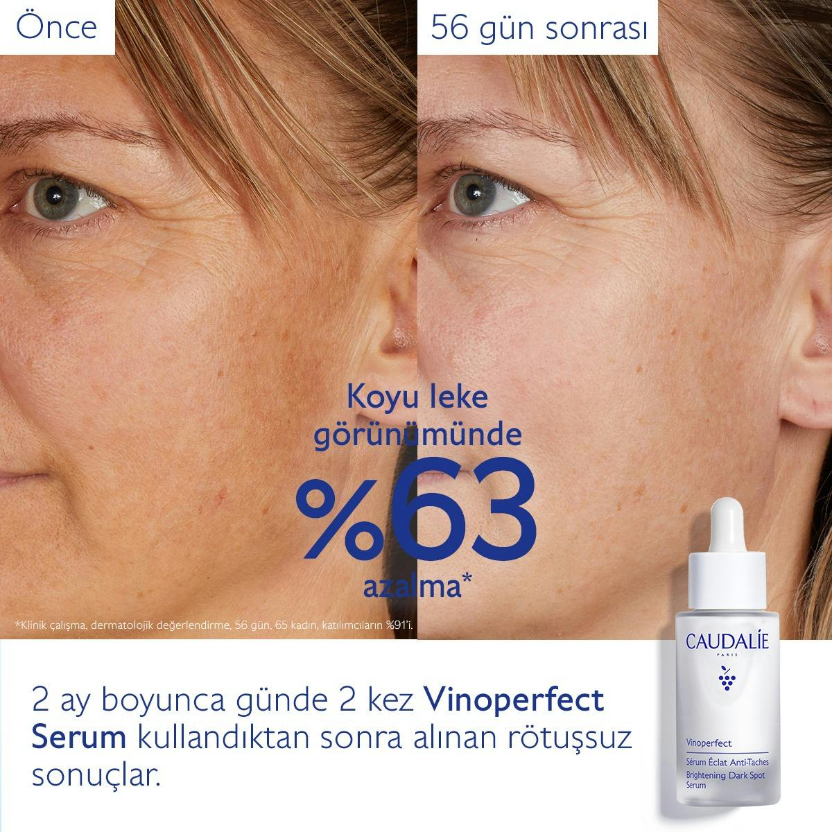 Leke Karşıtı Işıltı Verici Serum - 30ml