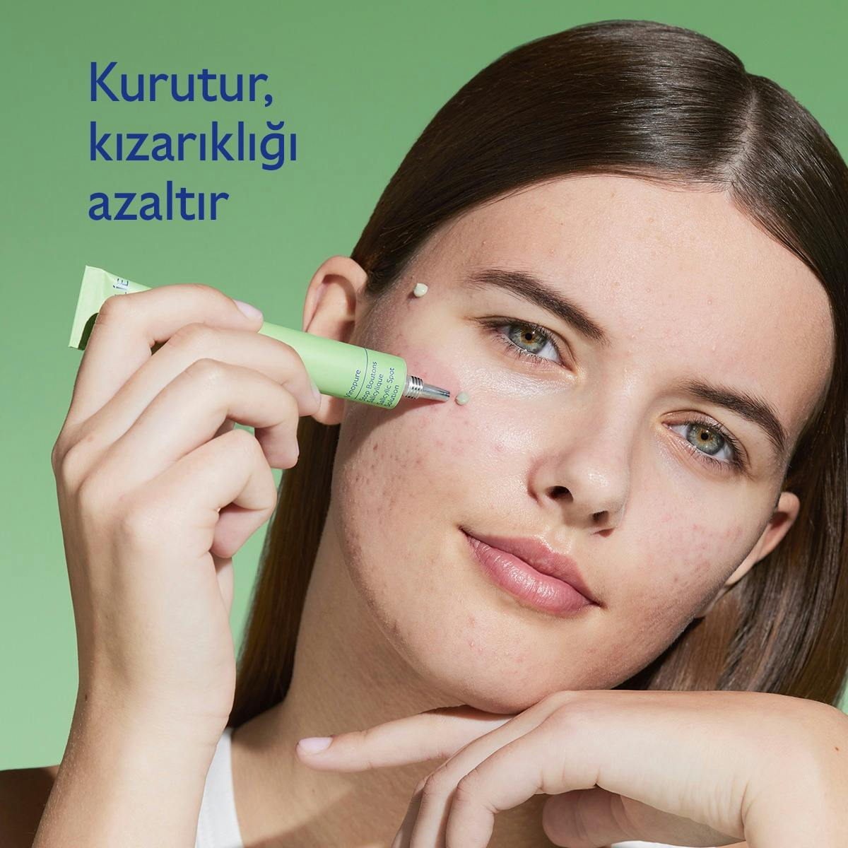 Akne Karşıtı Salisilik Spot Krem