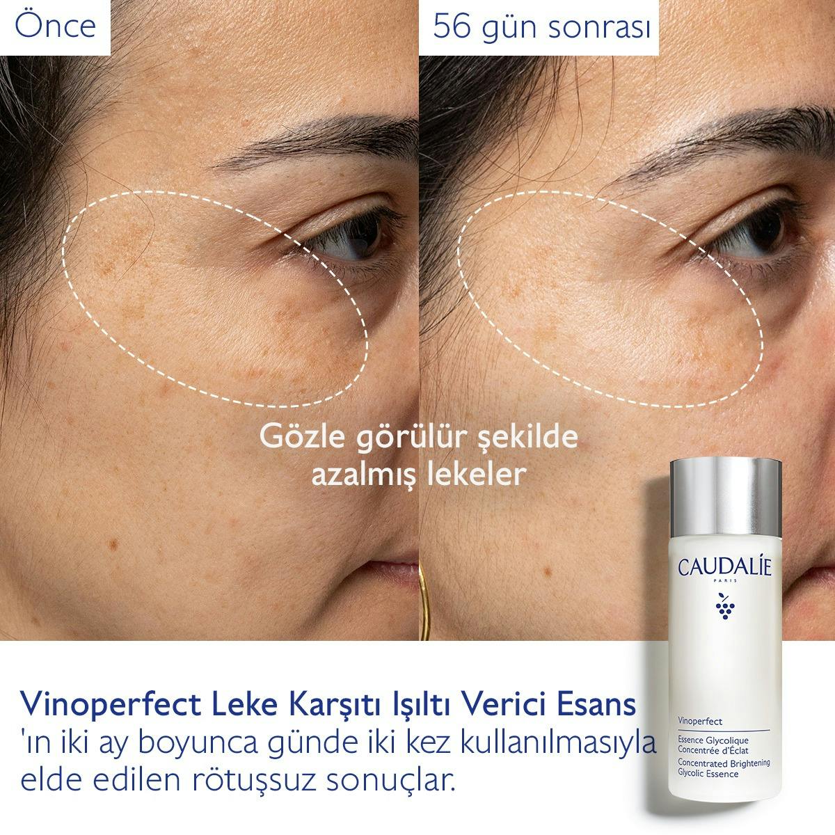 Leke Karşıtı Işıltı Verici Esans