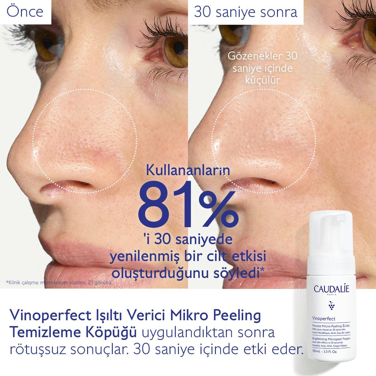 Vinoperfect Işıltı Verici Mikro Peeling Temizleme Köpüğü